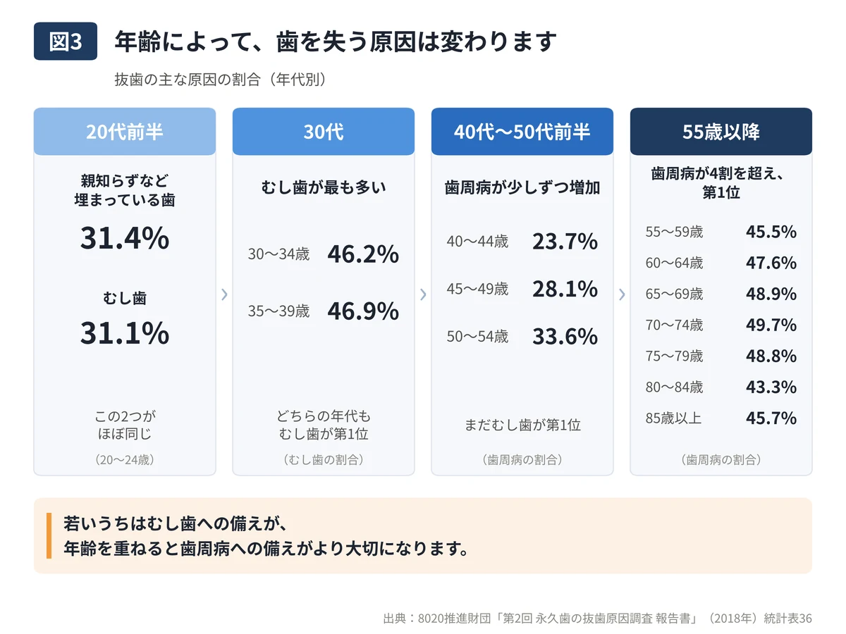 図3：年代による抜歯の原因の変化。20代前半は親知らずなど埋まっている歯31.4%とむし歯31.1%がほぼ同じ、30代はむし歯が46%台で最多、40代から50代前半は歯周病が23.7%から33.6%へ増加、55歳以降は歯周病が43〜50%で第1位